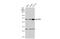 Telomeric repeat-binding factor 2 antibody, GTX132780, GeneTex, Western Blot image 