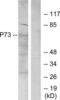 Tumor Protein P73 antibody, LS-C118219, Lifespan Biosciences, Western Blot image 