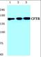 CF Transmembrane Conductance Regulator antibody, orb181511, Biorbyt, Western Blot image 