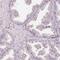 TIMELESS-interacting protein antibody, PA5-58892, Invitrogen Antibodies, Immunohistochemistry frozen image 