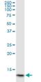 Hemoglobin Subunit Alpha 2 antibody, H00003039-M02, Novus Biologicals, Western Blot image 