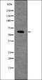 Checkpoint Kinase 2 antibody, orb336080, Biorbyt, Western Blot image 