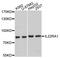 Interleukin 22 Receptor Subunit Alpha 1 antibody, A10941, ABclonal Technology, Western Blot image 