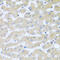 Branched Chain Keto Acid Dehydrogenase Kinase antibody, 23-450, ProSci, Immunohistochemistry paraffin image 