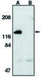 Apoptotic Peptidase Activating Factor 1 antibody, MBS395694, MyBioSource, Western Blot image 