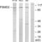 Proteasome 26S Subunit, Non-ATPase 2 antibody, abx013613, Abbexa, Western Blot image 