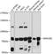 Mannosidase Alpha Class 1B Member 1 antibody, GTX03414, GeneTex, Western Blot image 