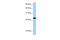 Chromosome 19 Open Reading Frame 24 antibody, 29-440, ProSci, Western Blot image 