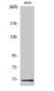 DEAD-Box Helicase 19B antibody, A10099-1, Boster Biological Technology, Western Blot image 