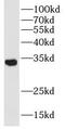 Solute Carrier Family 25 Member 1 antibody, FNab07927, FineTest, Western Blot image 