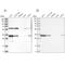 Protein Activator Of Interferon Induced Protein Kinase EIF2AK2 antibody, NBP2-55124, Novus Biologicals, Western Blot image 