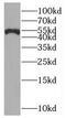 Interleukin 1 Receptor Associated Kinase 4 antibody, FNab04383, FineTest, Western Blot image 