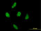 Serine/threonine-protein kinase 51PK antibody, LS-C198432, Lifespan Biosciences, Immunofluorescence image 