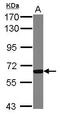 Glucokinase regulatory protein antibody, GTX117492, GeneTex, Western Blot image 