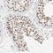 Ankyrin Repeat And LEM Domain Containing 2 antibody, NBP1-82970, Novus Biologicals, Immunohistochemistry paraffin image 