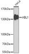 ABL Proto-Oncogene 1, Non-Receptor Tyrosine Kinase antibody, 13-126, ProSci, Western Blot image 