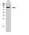 LIM domain kinase 2 antibody, STJ93931, St John