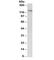 Patched 1 antibody, R33752-100UG, NSJ Bioreagents, Western Blot image 