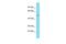 Glucoside Xylosyltransferase 1 antibody, PA5-70903, Invitrogen Antibodies, Western Blot image 