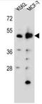 Aspartyl Aminopeptidase antibody, AP51305PU-N, Origene, Western Blot image 