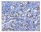 O-GlcNAcase antibody, A32463, Boster Biological Technology, Immunohistochemistry paraffin image 