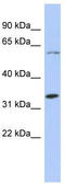 Zinc Finger Protein 8 antibody, TA345321, Origene, Western Blot image 