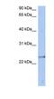 ATPase H+ Transporting V1 Subunit E2 antibody, NBP1-54601, Novus Biologicals, Western Blot image 