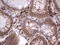 Tissue Factor Pathway Inhibitor 2 antibody, LS-C339523, Lifespan Biosciences, Immunohistochemistry paraffin image 