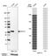 Aldo-Keto Reductase Family 1 Member C1 antibody, HPA068265, Atlas Antibodies, Western Blot image 