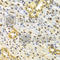 Tumor Protein P63 antibody, A2137, ABclonal Technology, Immunohistochemistry paraffin image 