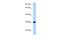 Pleckstrin Homology And FYVE Domain Containing 2 antibody, A09718, Boster Biological Technology, Western Blot image 