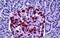 Hepatocyte Growth Factor-Regulated Tyrosine Kinase Substrate antibody, MBS247661, MyBioSource, Immunohistochemistry paraffin image 