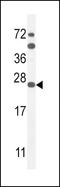 Sodium Voltage-Gated Channel Beta Subunit 1 antibody, LS-C162899, Lifespan Biosciences, Western Blot image 