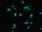 NOP58 Ribonucleoprotein antibody, LS-C317815, Lifespan Biosciences, Immunofluorescence image 