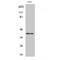 Alcohol Dehydrogenase 7 (Class IV), Mu Or Sigma Polypeptide antibody, LS-C381921, Lifespan Biosciences, Western Blot image 