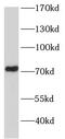 NCL4 antibody, FNab01218, FineTest, Western Blot image 