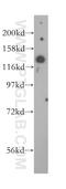 ArfGAP With GTPase Domain, Ankyrin Repeat And PH Domain 2 antibody, 14690-1-AP, Proteintech Group, Western Blot image 