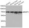 Angiopoietin 1 antibody, LS-B14394, Lifespan Biosciences, Western Blot image 