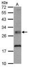 Thiamin pyrophosphokinase 1 antibody, GTX103943, GeneTex, Western Blot image 