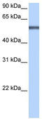 Leucine Rich Repeat Containing 8 VRAC Subunit E antibody, TA338693, Origene, Western Blot image 