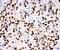 Progesterone Receptor antibody, PB9009, Boster Biological Technology, Immunohistochemistry paraffin image 