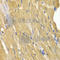 Adenylate Kinase 1 antibody, A1218, ABclonal Technology, Immunohistochemistry paraffin image 