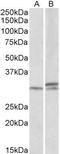HOXA9 antibody, GTX88093, GeneTex, Western Blot image 