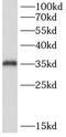 Thymidine Kinase 2 antibody, FNab10010, FineTest, Western Blot image 