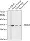 Proteasome Activator Subunit 2 antibody, 15-112, ProSci, Western Blot image 