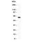 Somatostatin Receptor 1 antibody, R30778, NSJ Bioreagents, Western Blot image 