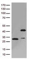 GIPC PDZ Domain Containing Family Member 1 antibody, LS-C796195, Lifespan Biosciences, Western Blot image 