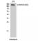 Histone Deacetylase 6 antibody, LS-C381518, Lifespan Biosciences, Western Blot image 