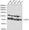 Calpain 1 antibody, GTX32486, GeneTex, Western Blot image 