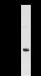 Histidyl-TRNA Synthetase antibody, LS-C342343, Lifespan Biosciences, Immunoprecipitation image 